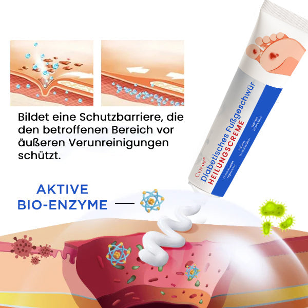 Cvreoz® Diabetisches Fußgeschwür Heilungscreme