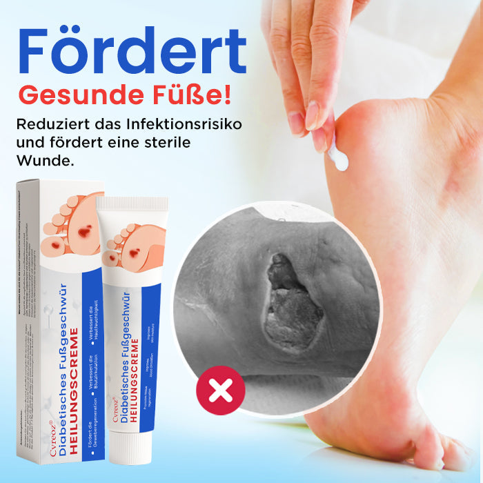 Cvreoz® Diabetisches Fußgeschwür Heilungscreme