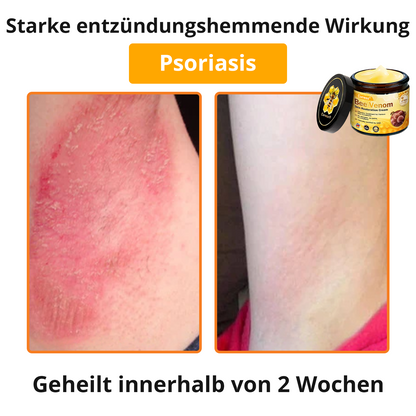 🐝 Cvreoz® Bienengift Hautreparatur Creme
