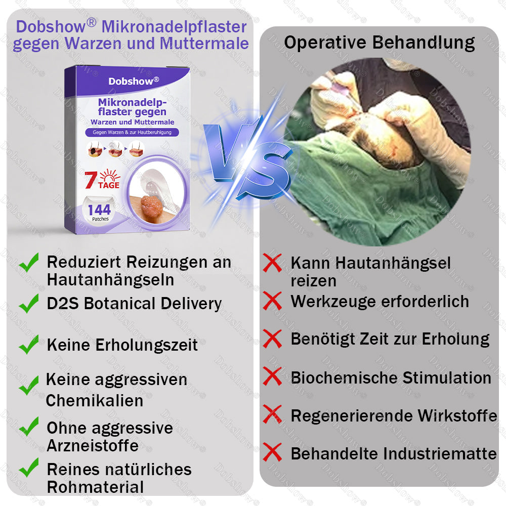 Dobshow® Mikronadelpflaster gegen Warzen und Muttermale