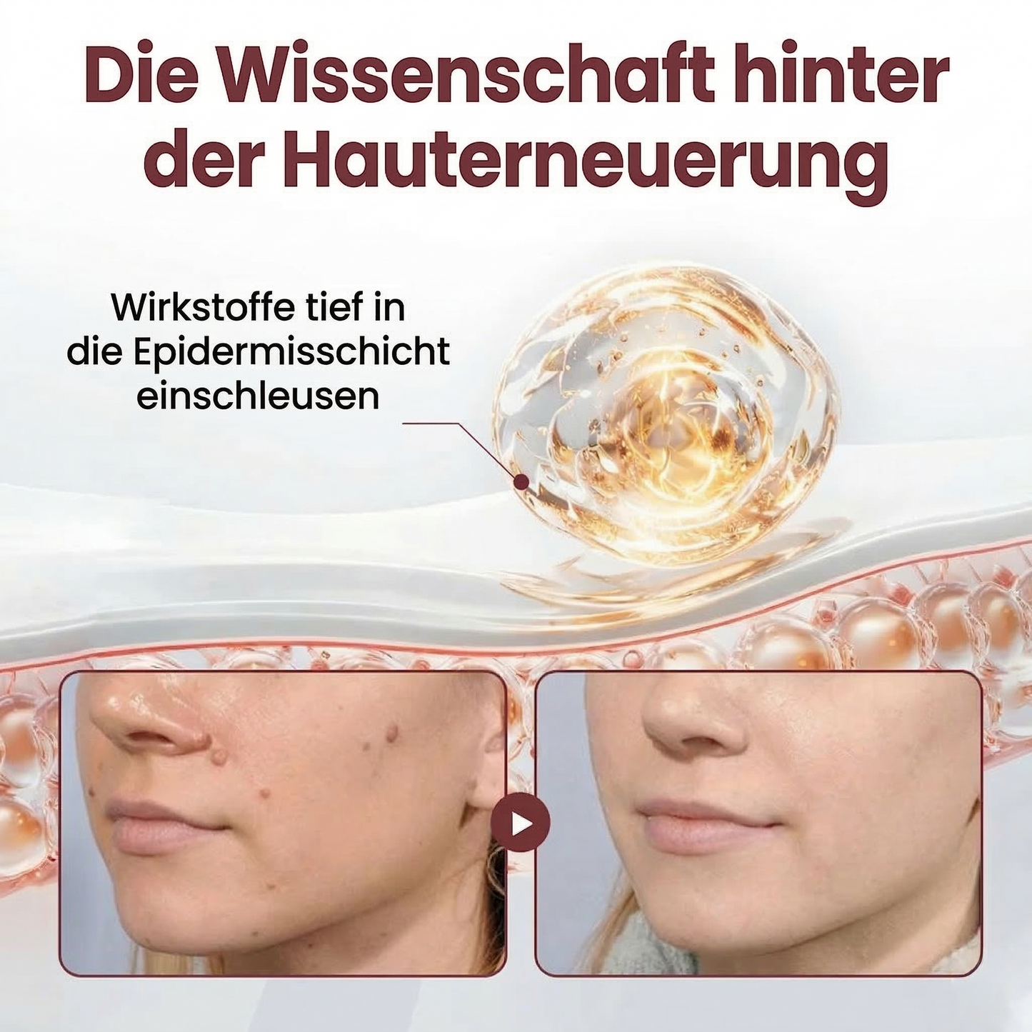 ⭐ Bestseller  | Healrize® Schwarzer Reis Dual-Wirkung Korrekturcreme für Warzen