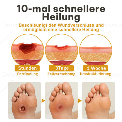 🐝DE 𝐎𝐟𝐟𝐢𝐜𝐢𝐚𝐥  𝐒𝐭𝐨𝐫𝐞 |Healrize® GlucoShield Bienengift-Wundspray