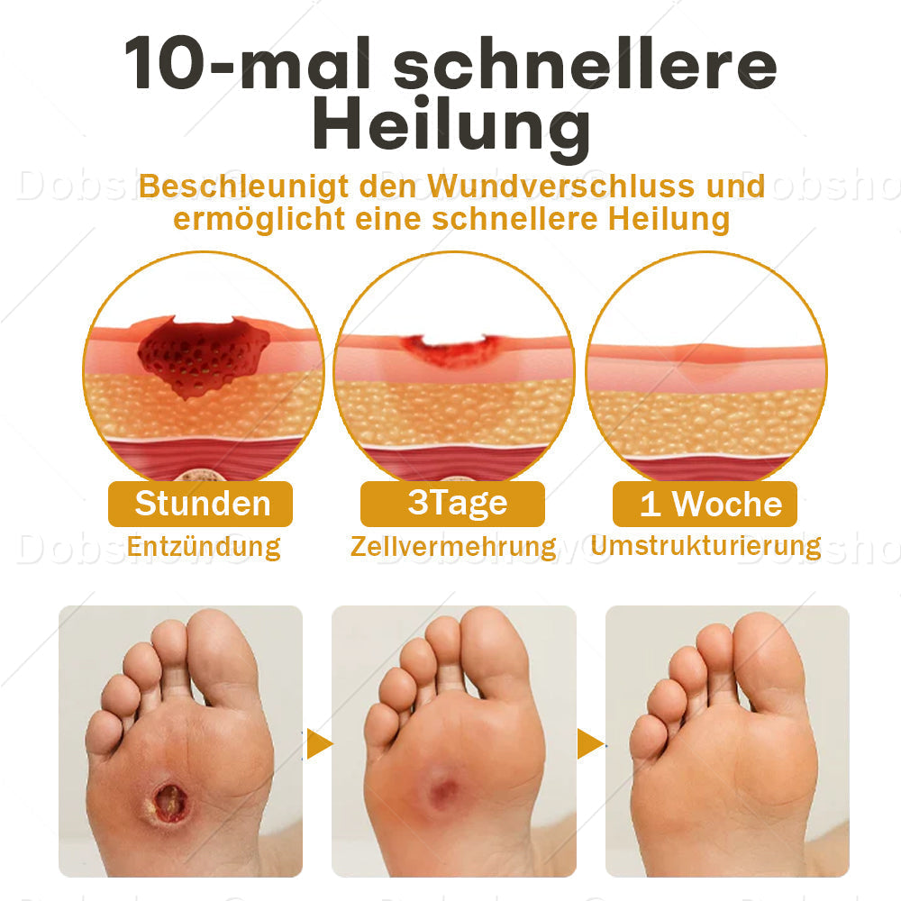 ✨DE 𝐎𝐟𝐟𝐢𝐜𝐢𝐚𝐥  𝐒𝐭𝐨𝐫𝐞 |Healrize® GlucoShield Bienengift-Wundspray🔥 𝙉𝙧. 1 𝘽𝙚𝙨𝙩𝙨𝙚𝙡𝙡𝙚𝙧 𝙎𝙥𝙧𝙖𝙮 𝙛ü𝙧 𝘿𝙞𝙖𝙗𝙚𝙩𝙞𝙨𝙘𝙝𝙚 𝙁𝙪ß𝙥𝙛𝙡𝙚𝙜𝙚