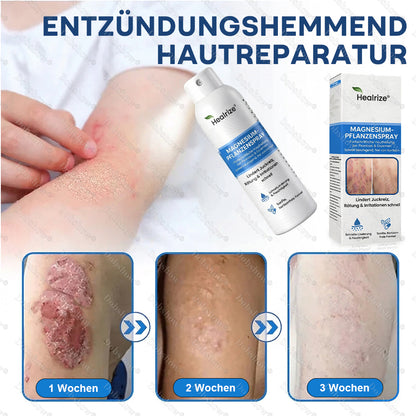 ✨DE 𝐎𝐟𝐟𝐢𝐜𝐢𝐚𝐥  𝐒𝐭𝐨𝐫𝐞 |Healrize® Magnesium-Pflanzenspray – Fortschrittliche Hautregeneration bei Schuppenflechte & Ekzemen | Schnelle Linderung, steroidfrei