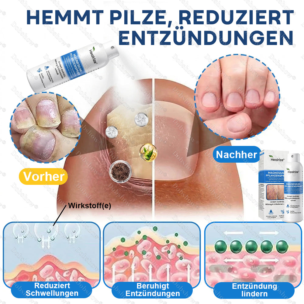 ✨DE 𝐎𝐟𝐟𝐢𝐜𝐢𝐚𝐥  𝐒𝐭𝐨𝐫𝐞 |Healrize® Magnesium-Pflanzenspray – Fortschrittliche Hautregeneration bei Schuppenflechte & Ekzemen | Schnelle Linderung, steroidfrei