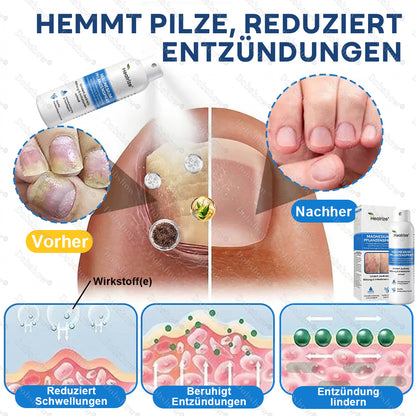 ✨DE 𝐎𝐟𝐟𝐢𝐜𝐢𝐚𝐥  𝐒𝐭𝐨𝐫𝐞 |Healrize® Magnesium-Pflanzenspray – Fortschrittliche Hautregeneration bei Schuppenflechte & Ekzemen | Schnelle Linderung, steroidfrei