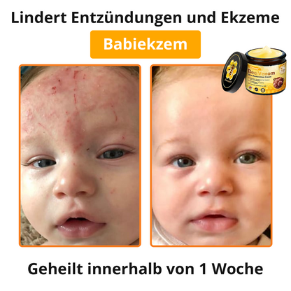 🐝 Cvreoz® Bienengift Hautreparatur Creme