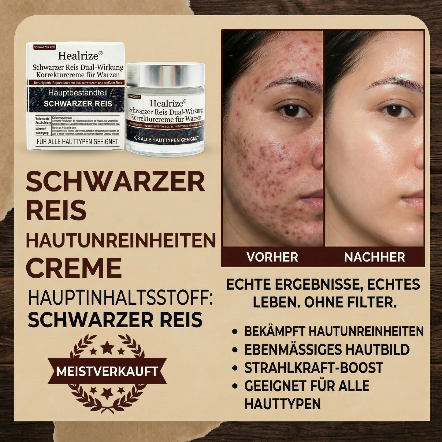 ⭐ Bestseller  | Healrize® Schwarzer Reis Dual-Wirkung Korrekturcreme für Warzen