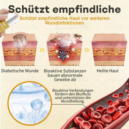 🐝DE 𝐎𝐟𝐟𝐢𝐜𝐢𝐚𝐥  𝐒𝐭𝐨𝐫𝐞 |Healrize® GlucoShield Bienengift-Wundspray