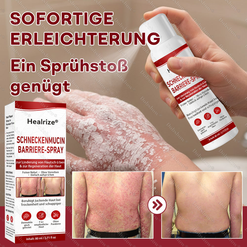 ⭐ Bestseller | Healrize® Schneckenmucin-Barriere-Spray zur Linderung von Hautschüben und zur Regeneration der Haut-𝘿𝙚𝙪𝙩𝙨𝙘𝙝𝙡𝙖𝙣𝙙𝙨 𝙉𝙧. 1 𝙨𝙥𝙧ü𝙝𝙗𝙖𝙧𝙚 𝘽𝙖𝙧𝙧𝙞𝙚𝙧𝙚-𝙋𝙛𝙡𝙚𝙜𝙚 𝙗𝙚𝙞 𝙋𝙨𝙤𝙧𝙞𝙖𝙨𝙞𝙨✨