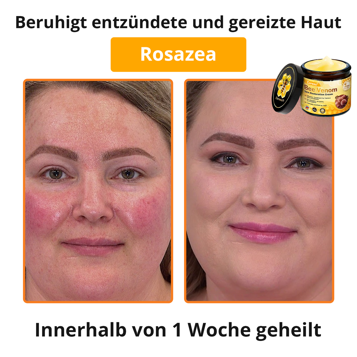 🐝 Cvreoz® Bienengift Hautreparatur Creme