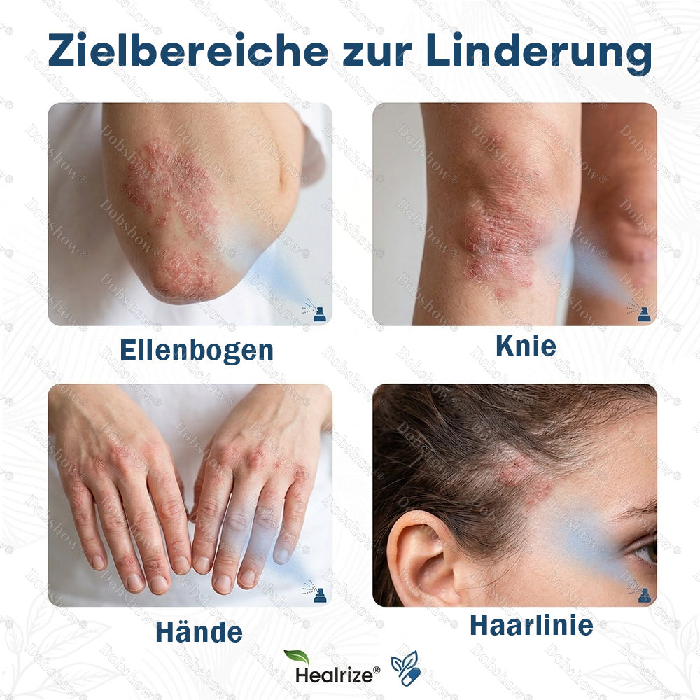 ✨DE 𝐎𝐟𝐟𝐢𝐜𝐢𝐚𝐥  𝐒𝐭𝐨𝐫𝐞 |Healrize® Magnesium-Pflanzenspray – Fortschrittliche Hautregeneration bei Schuppenflechte & Ekzemen | Schnelle Linderung, steroidfrei