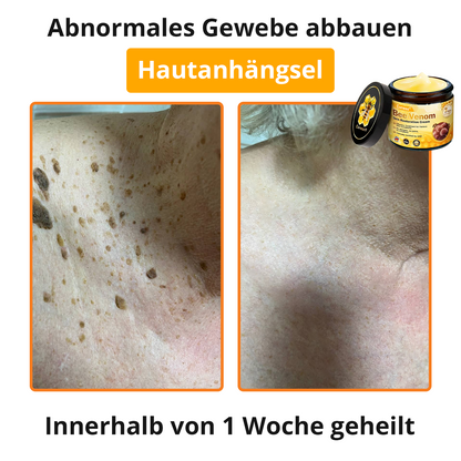 🐝 Cvreoz® Bienengift Hautreparatur Creme