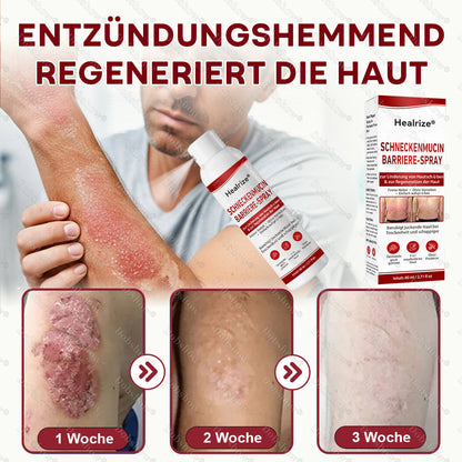 ✨Healrize® Schneckenmucin-Barriere-Spray zur Linderung von Hautschüben und zur Regeneration der Haut-𝘿𝙚𝙪𝙩𝙨𝙘𝙝𝙡𝙖𝙣𝙙𝙨 𝙉𝙧. 1 𝙨𝙥𝙧ü𝙝𝙗𝙖𝙧𝙚 𝘽𝙖𝙧𝙧𝙞𝙚𝙧𝙚-𝙋𝙛𝙡𝙚𝙜𝙚 𝙗𝙚𝙞 𝙋𝙨𝙤𝙧𝙞𝙖𝙨𝙞𝙨✨