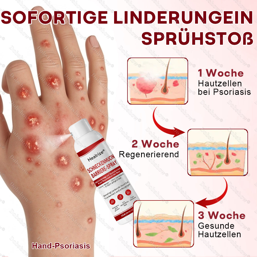 ✨Healrize® Schneckenmucin-Barriere-Spray zur Linderung von Hautschüben und zur Regeneration der Haut-𝘿𝙚𝙪𝙩𝙨𝙘𝙝𝙡𝙖𝙣𝙙𝙨 𝙉𝙧. 1 𝙨𝙥𝙧ü𝙝𝙗𝙖𝙧𝙚 𝘽𝙖𝙧𝙧𝙞𝙚𝙧𝙚-𝙋𝙛𝙡𝙚𝙜𝙚 𝙗𝙚𝙞 𝙋𝙨𝙤𝙧𝙞𝙖𝙨𝙞𝙨✨
