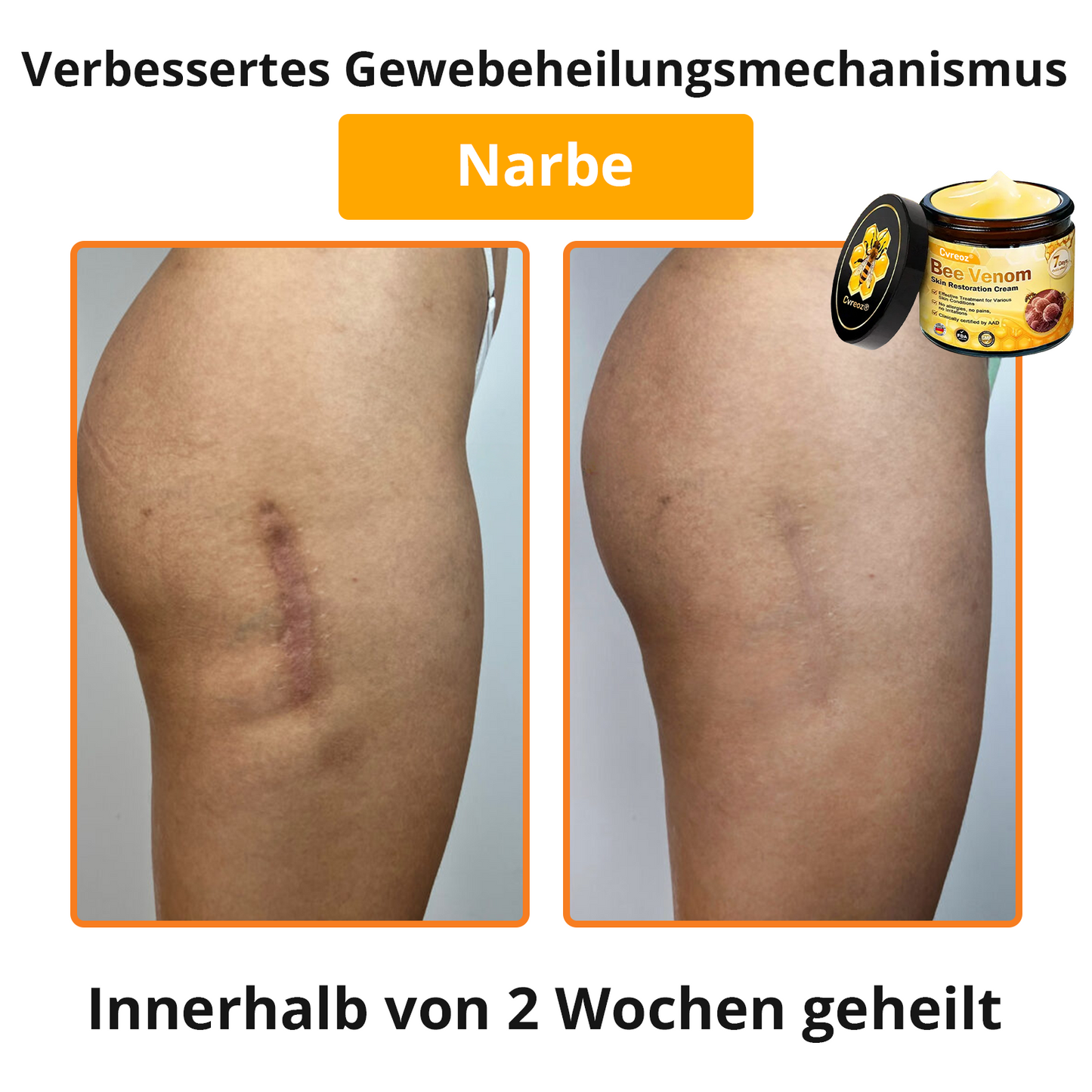 🐝 Cvreoz® Bienengift Hautreparatur Creme