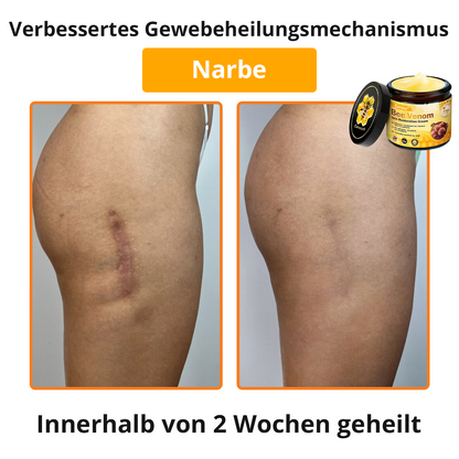 🐝 Cvreoz® Bienengift Hautreparatur Creme