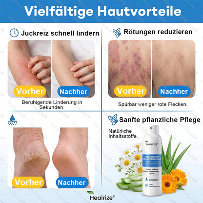 ✨DE 𝐎𝐟𝐟𝐢𝐜𝐢𝐚𝐥  𝐒𝐭𝐨𝐫𝐞 |Healrize® Magnesium-Pflanzenspray – Fortschrittliche Hautregeneration bei Schuppenflechte & Ekzemen | Schnelle Linderung, steroidfrei