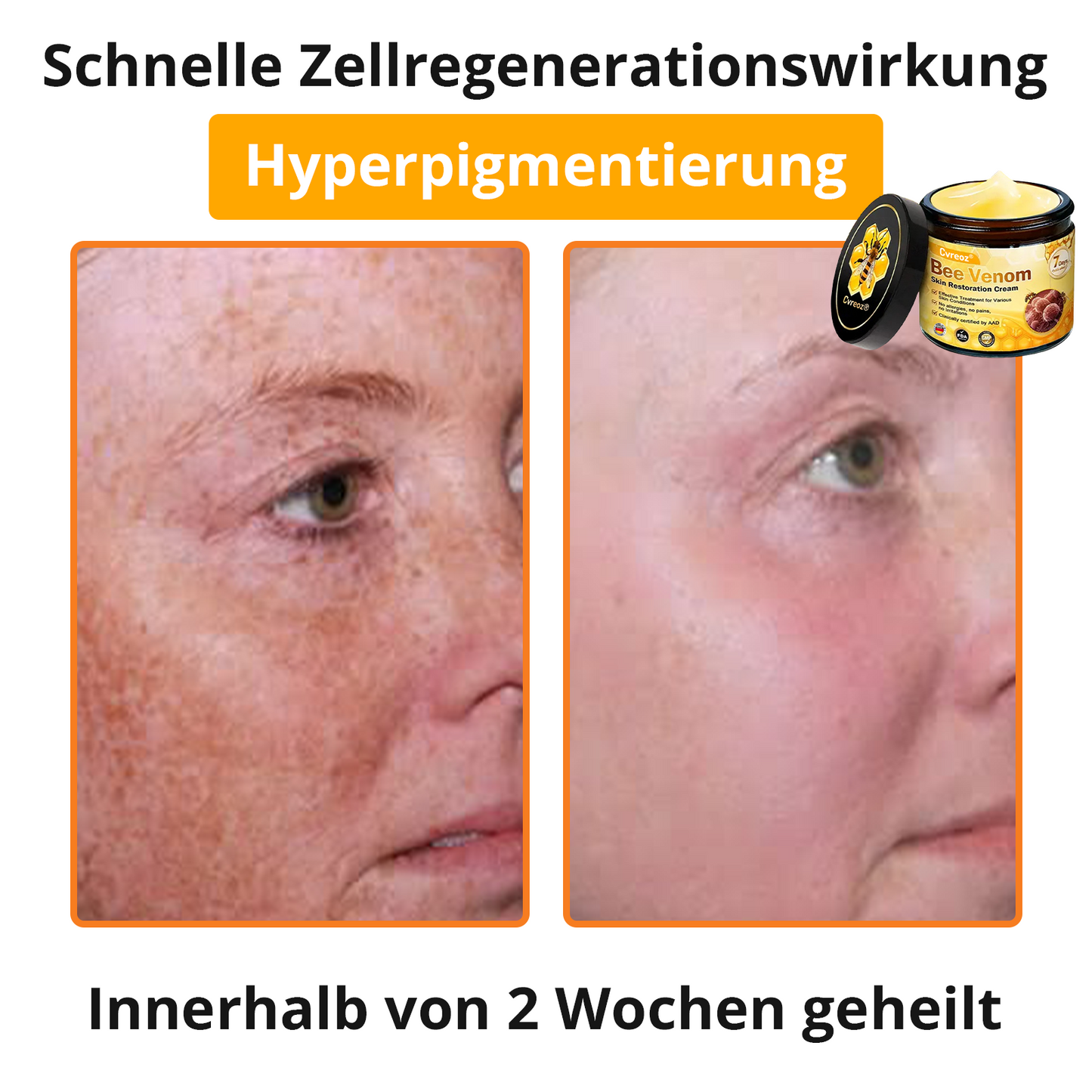 🐝 Cvreoz® Bienengift Hautreparatur Creme