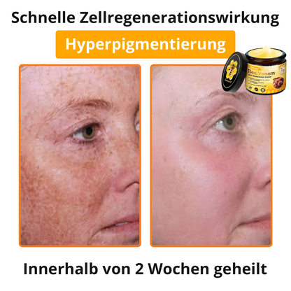 🐝 Cvreoz® Bienengift Hautreparatur Creme