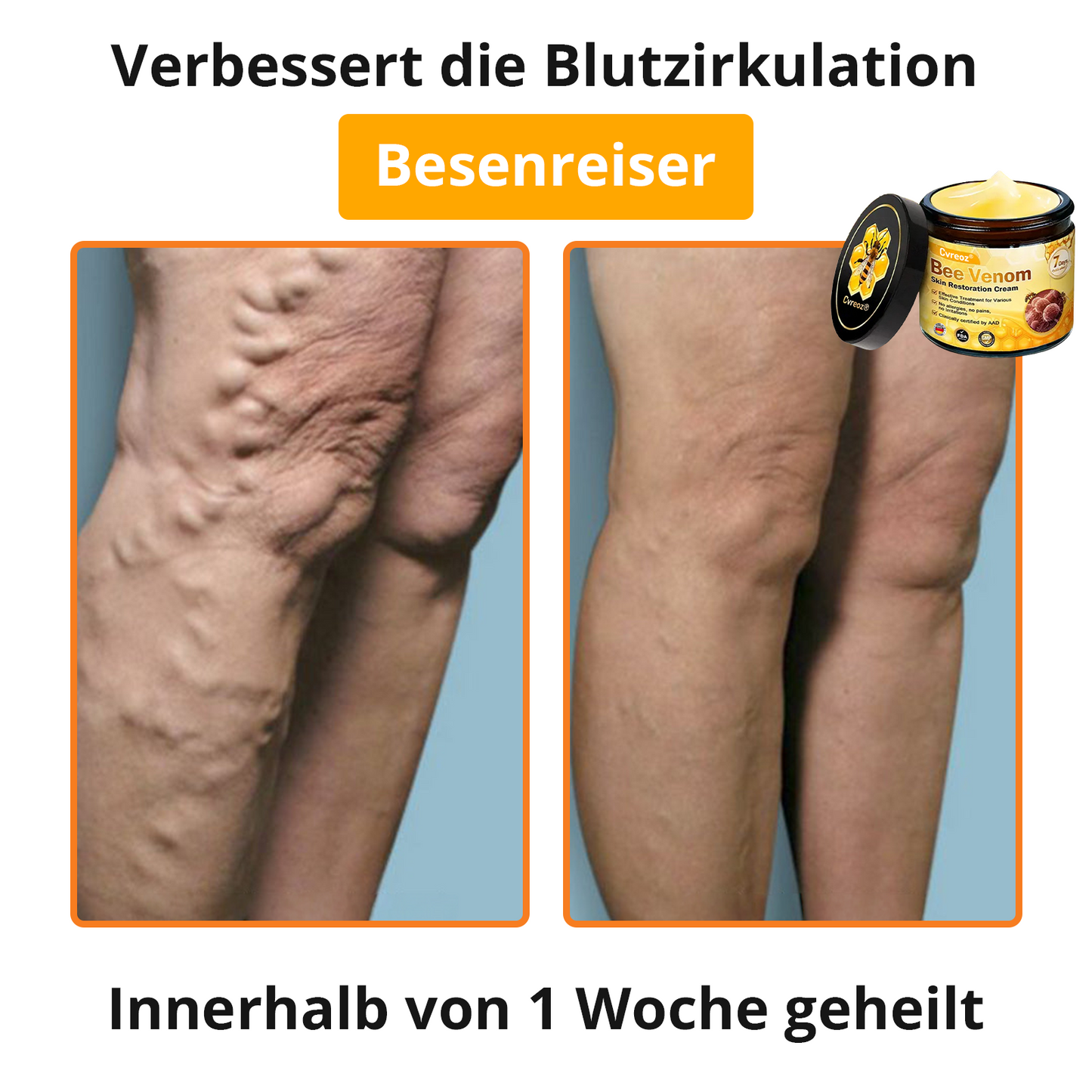 🐝 Cvreoz® Bienengift Hautreparatur Creme