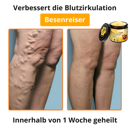 🐝 Cvreoz® Bienengift Hautreparatur Creme