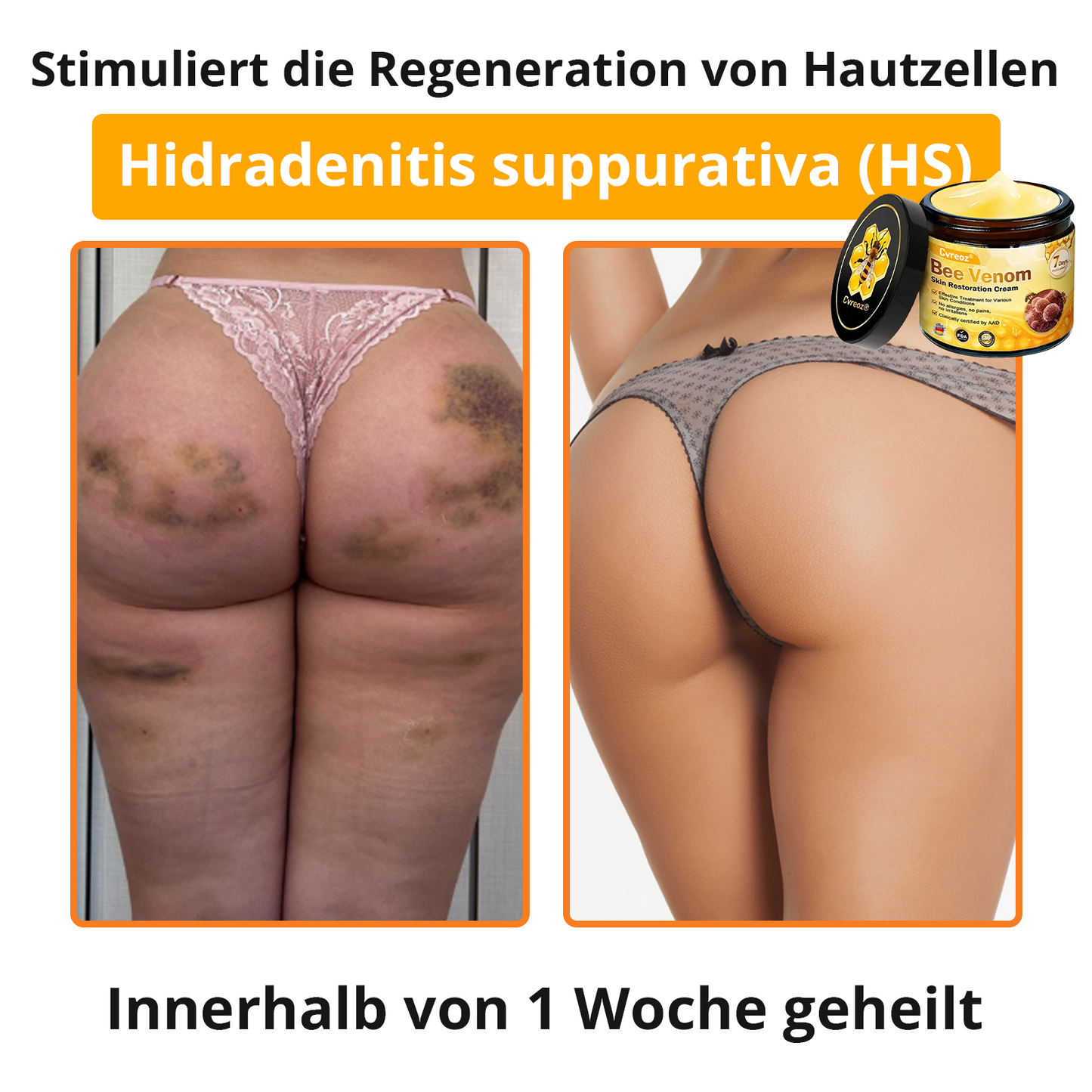 🐝 Cvreoz® Bienengift Hautreparatur Creme