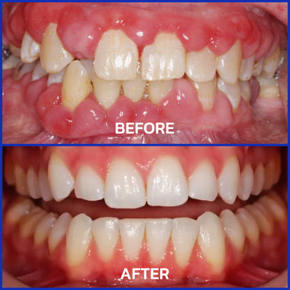 Dobshow® Bienengift DentalMikrogranulat  (🇩🇪 🦷 Zugelassen)