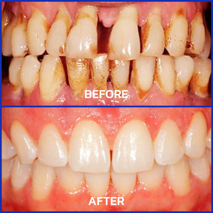 Dobshow® Bienengift DentalMikrogranulat  (🇩🇪 🦷 Zugelassen)